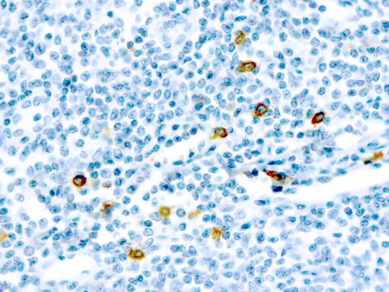 Mast Cell Chymase