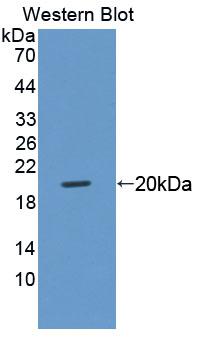 Polyclonal Antibody to Prostaglandin E Receptor 1 (EP1)
