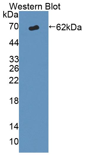 Polyclonal Antibody to ATP Binding Cassette Transporter D1 (D1)