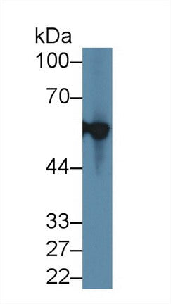 Polyclonal Antibody to Cytokeratin 12 (CK12)