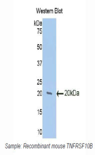 Polyclonal Antibody to Death receptor 5 (DR5)