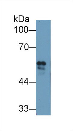 Polyclonal Antibody to Fibrinogen Beta Chain (FGB)