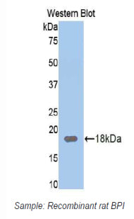 Polyclonal Antibody to Bactericidal/Permeability Increasing Protein (BPI)