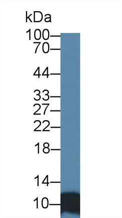 Polyclonal Antibody to Signal Recognition Particle 9kDa (SRP9)