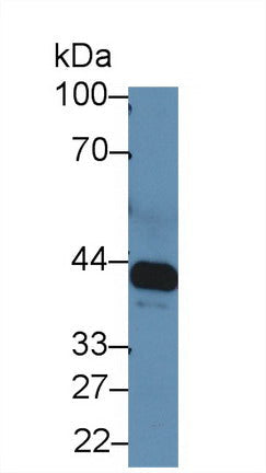 Polyclonal Antibody to Interleukin 6 Receptor (IL6R)