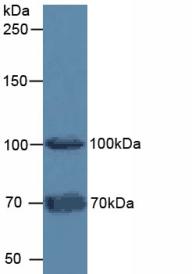 Polyclonal Antibody to Fibroblast Activation Protein Alpha (FAPa)
