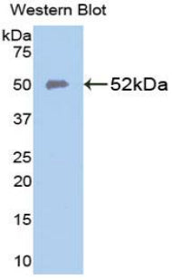 Polyclonal Antibody to Ferroportin (FPN)