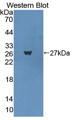 Polyclonal Antibody to Leupaxin (LPXN)