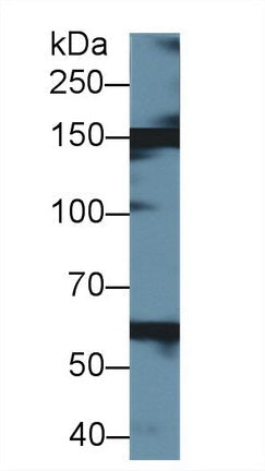 Polyclonal Antibody to Xanthine Dehydrogenase (XDH)