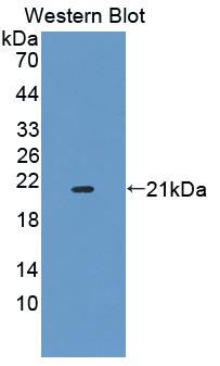 Polyclonal Antibody to Dystrophia Myotonica Protein Kinase (DMPK)