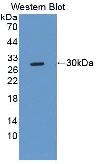Polyclonal Antibody to Membrane Protein, Palmitoylated 3 (MPP3)