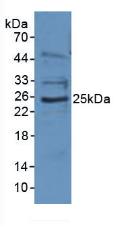 Polyclonal Antibody to Epstein Barr Virus Induced Protein 3 (EBI3)
