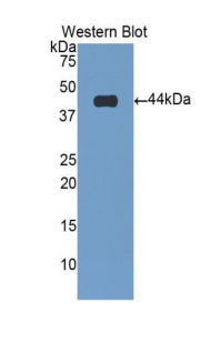 Polyclonal Antibody to Troponin T Type 2, Cardiac (TNNT2)