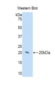 Polyclonal Antibody to Interleukin 17 Receptor D (IL17RD)