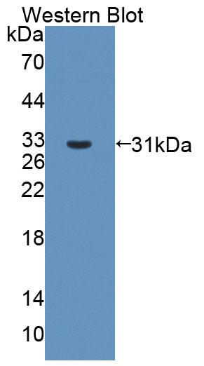 Polyclonal Antibody to ATP Binding Cassette Transporter B6 (B6)