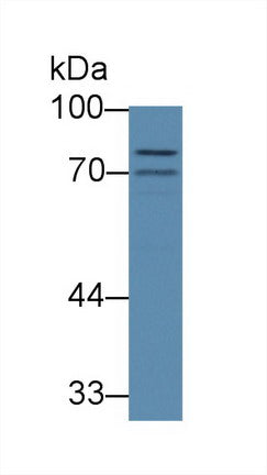 Polyclonal Antibody to ATP Binding Cassette Transporter B8 (B8)