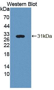 Polyclonal Antibody to Phospholipase A2, Group III (PLA2G3)