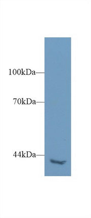 Polyclonal Antibody to Phospholipase C Eta 2 (PLCh2)