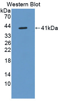 Polyclonal Antibody to Defensin Alpha 6, Paneth Cell Specific (DEFa6)