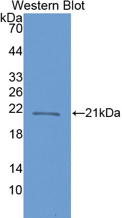 Polyclonal Antibody to Crystallin Beta B1 (CRYbB1)