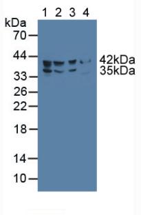 Polyclonal Antibody to Fatty Acid Desaturase 2 (FADS2)