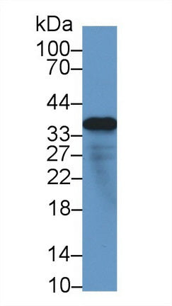 Polyclonal Antibody to Microfibrillar Associated Protein 4 (MFAP4)
