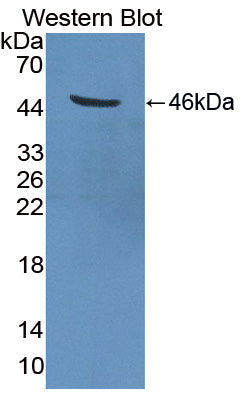 Polyclonal Antibody to Transmembrane Protease, Serine 4 (TMPRSS4)