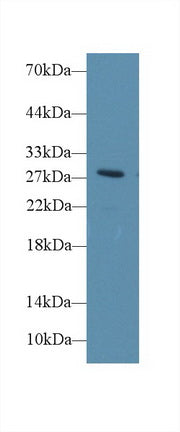 Polyclonal Antibody to Deiodinase, Iodothyronine, Type III (DIO3)