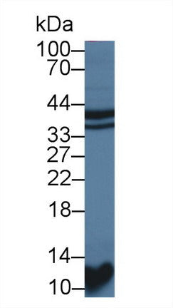 Polyclonal Antibody to Signal Transducing Adaptor Protein 1 (STAP1)