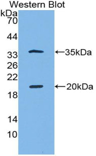 Polyclonal Antibody to Serine Peptidase Inhibitor Kazal Type 5 (SPINK5)