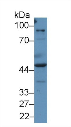 Polyclonal Antibody to Preferentially Expressed Antigen In Melanoma (PRAME)