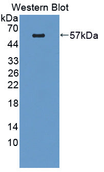 Polyclonal Antibody to Pleckstrin Homology Domain Containing Family A, Member 1 (PLEKHA1)