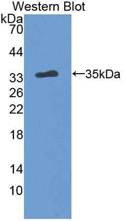 Polyclonal Antibody to Bridging Integrator 2 (BIN2)
