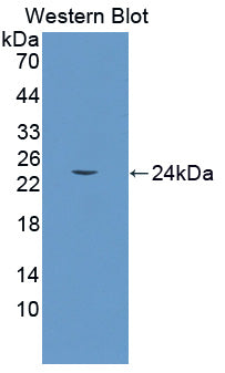 Polyclonal Antibody to Growth Arrest And DNA Damage Inducible Protein Gamma (GADD45g)