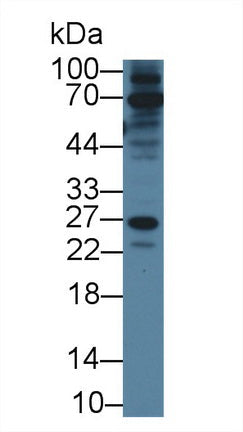 Polyclonal Antibody to RAB37, Member RAS Oncogene Family (RAB37)