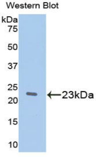 Polyclonal Antibody to Retinol Binding Protein 5, Cellular (RBP5)
