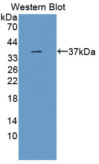 Polyclonal Antibody to SRSF Protein Kinase 3 (SRPK3)