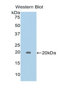 Polyclonal Antibody to Galectin 5 (GAL5)