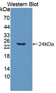 Polyclonal Antibody to Ribonuclease A11 (RNASE11)