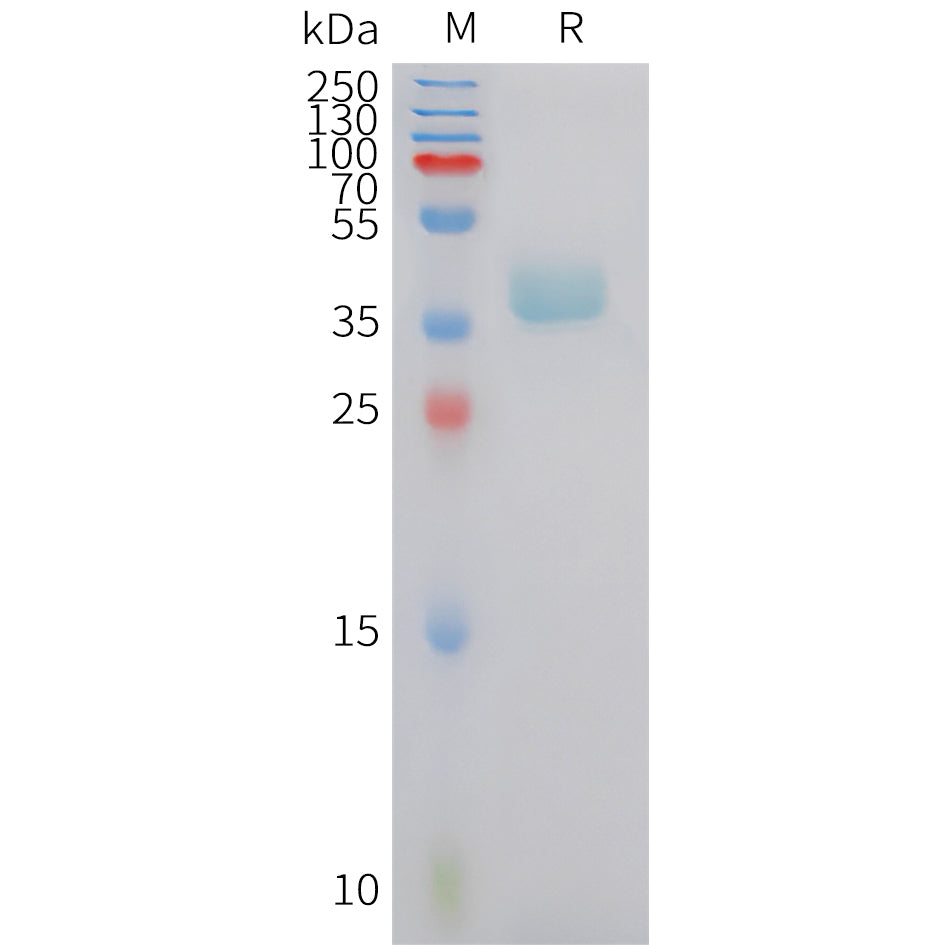 Human CXCR6 Protein, hFc Tag