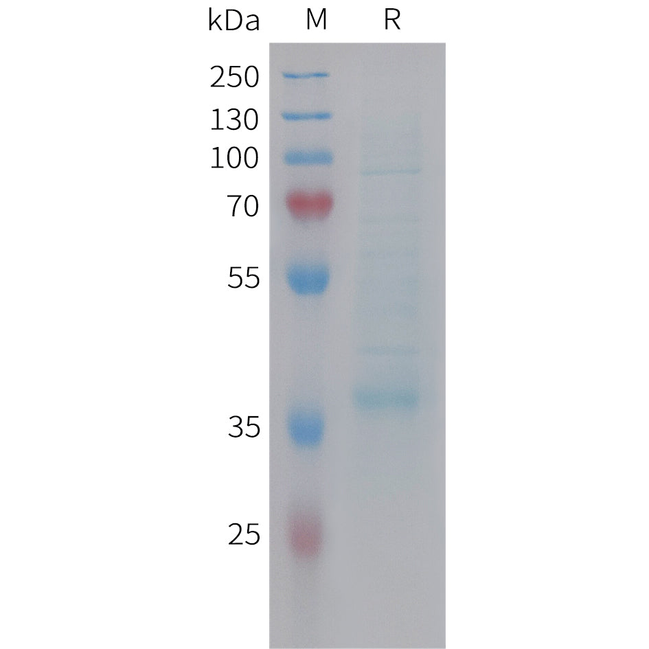 Human CCL19 Protein, hFc Tag