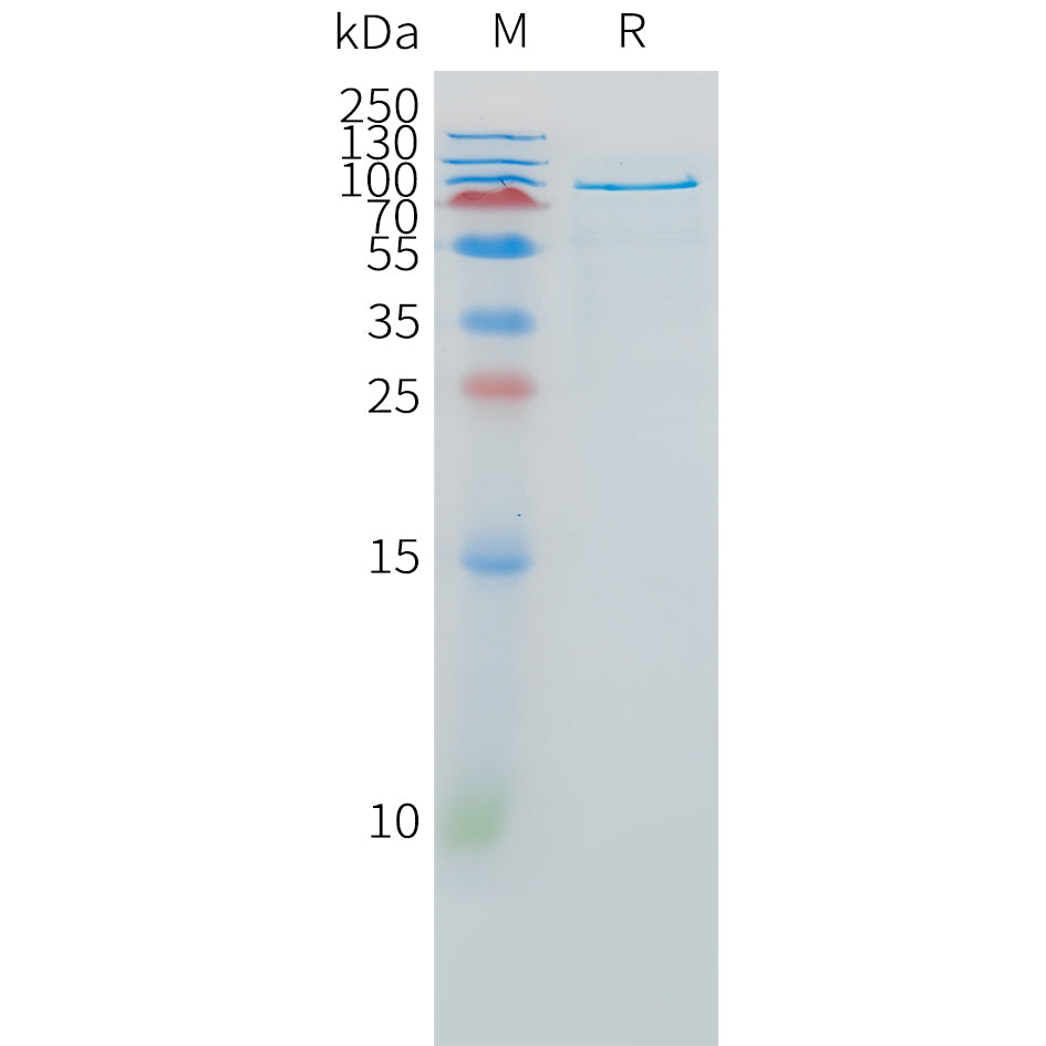 Human HGF(1-728) Protein, hFc Tag