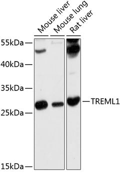 TREML1 Rabbit pAb