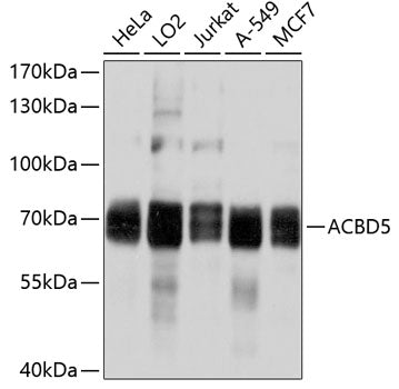 ACBD5 Rabbit pAb