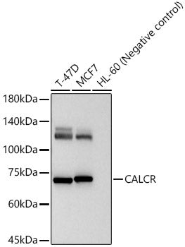 CALCR Rabbit pAb