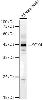 SOX4 Rabbit pAb