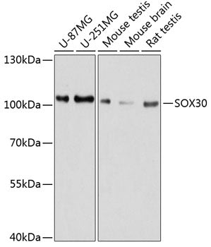 SOX30 Rabbit pAb