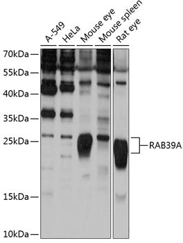 RAB39A Rabbit pAb