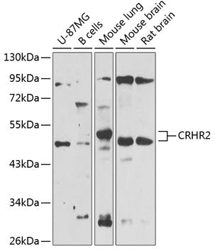 CRHR2 Rabbit pAb