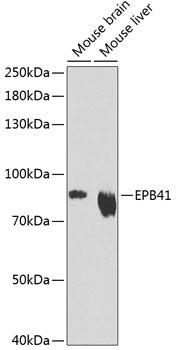 EPB41 Rabbit pAb